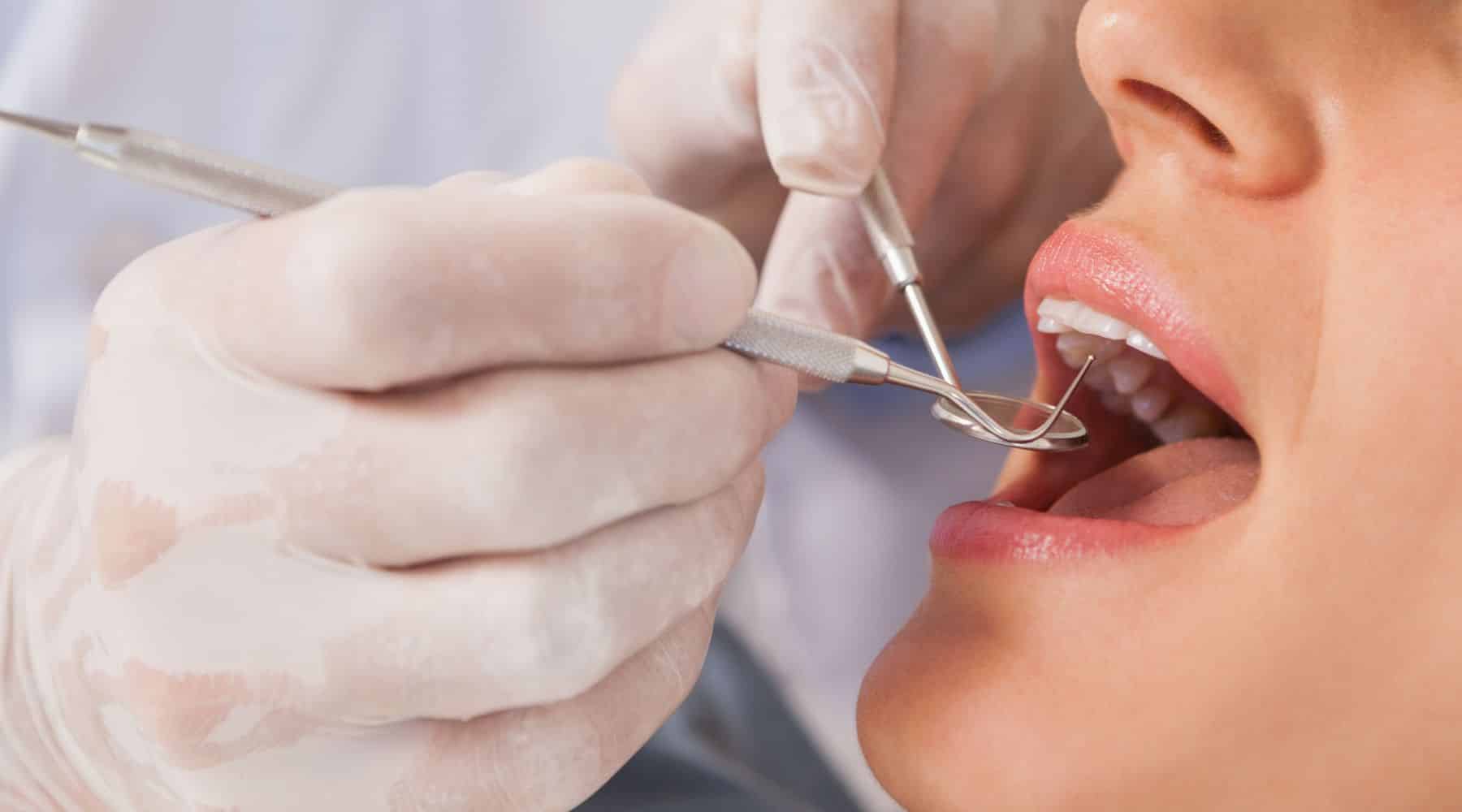 Woman having teeth checked by a dentist